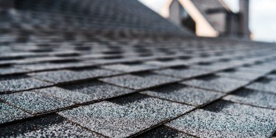 Shingles
